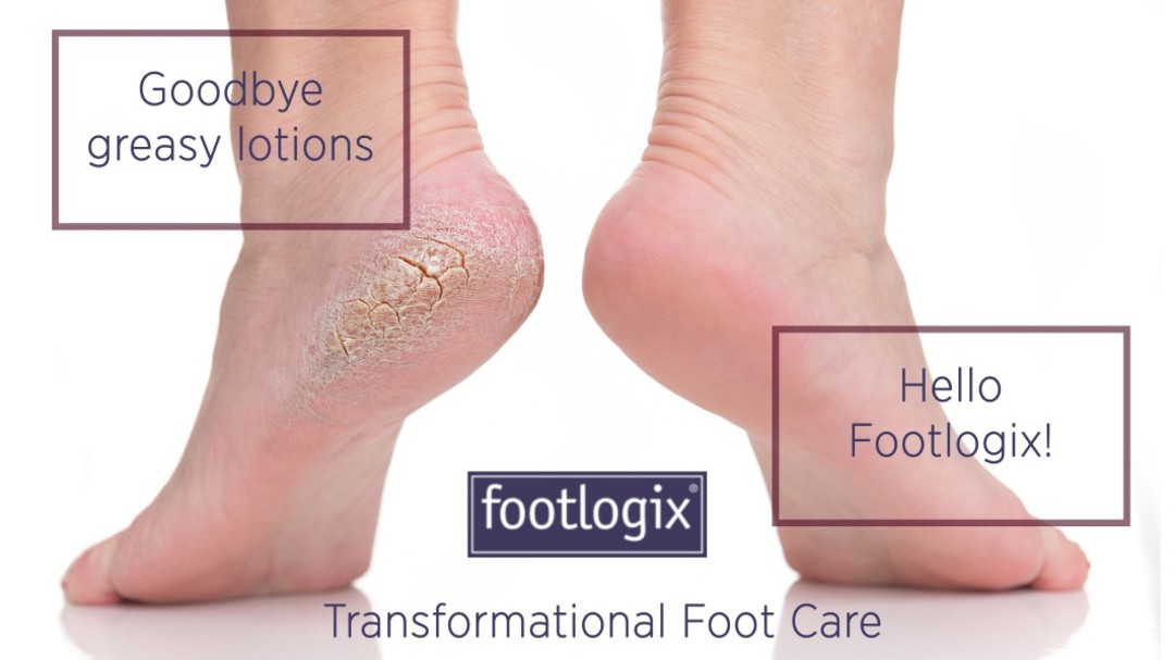 Footlogix