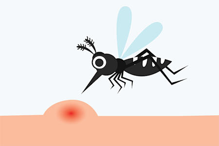 illustration of mosquito stinging skin