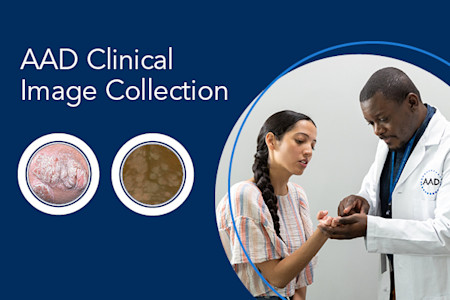 Image for New Clinical Image Collection helps enhance patient care