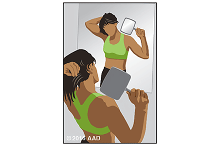 Illustration of a person holding a hand mirror examining their neck and scalp for signs of skin cancer