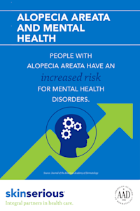 alopecia infographic