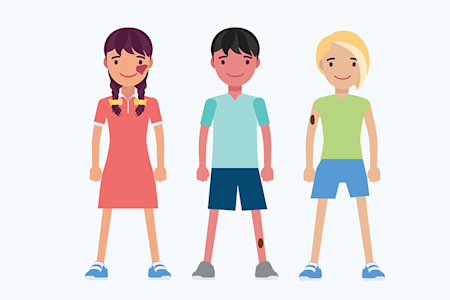 illustration of kids with birthmarks