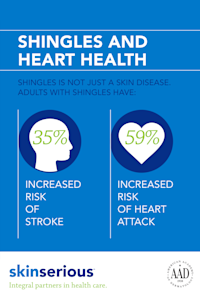 shingles infographic