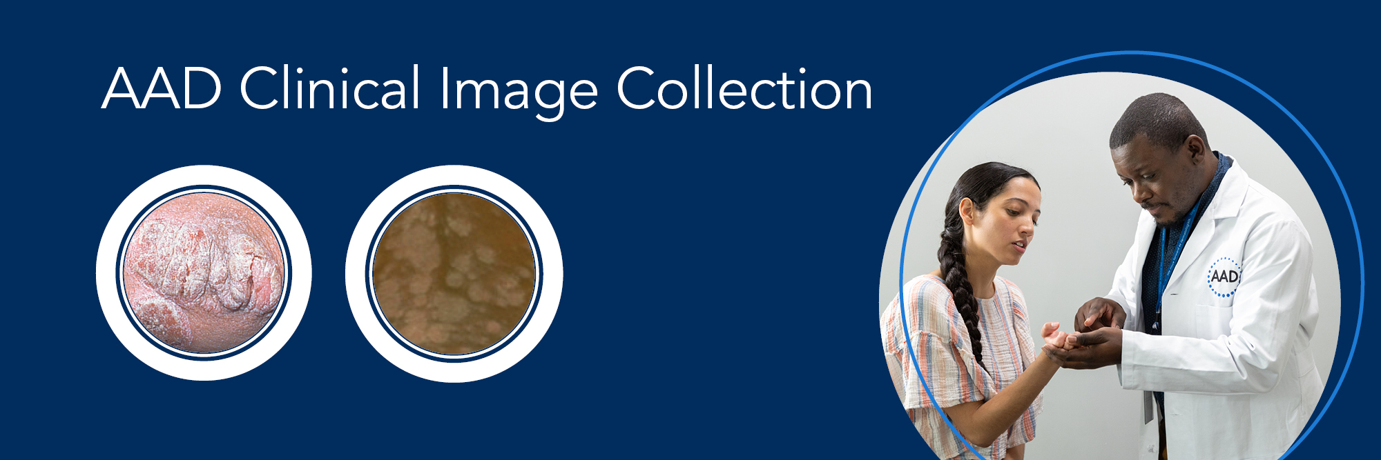 Banner image for New AAD Clinical Image Collection helps enhance patient care
