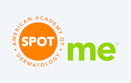 SPOT card image for volunteer landing page