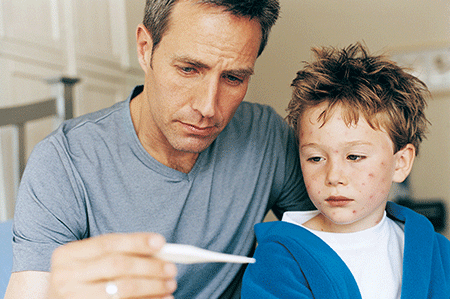 Father checking temperature of son sick with chickenpox