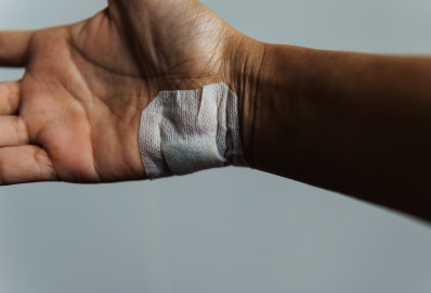 Injured hand with silicone bandage sheet