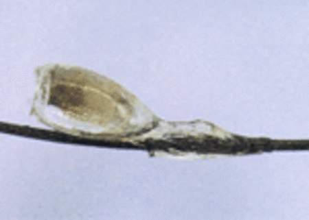 Magnified picture of a nit