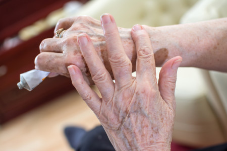 Close-up of elderly woman's hands applying cream from tube