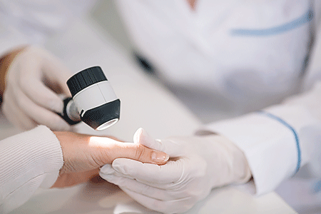 Dermatologist using dermatoscope to examine patient’s hand