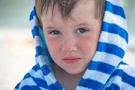 A little boy with red, irritated face with a towel over his head