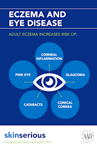 eczema infographic