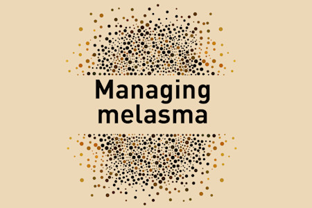 The emotional toll of melasma on patients can be devastating. Dermatologists discuss new understandings of its pathogenesis and emerging treatments.