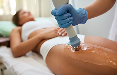 A woman getting acoustic wave therapy