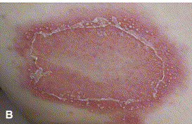 Image for DWII Paradoxical biological reactions and Grandma Dora’s waterbed