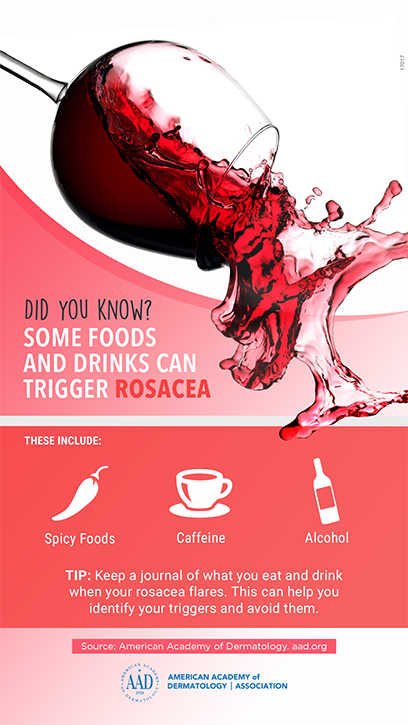 Rosacea food triggers