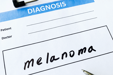 Diagnosis melanoma in a medical form on the doctor desk