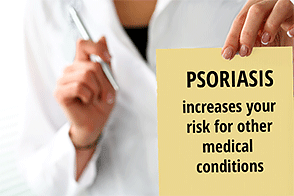 Doctor holding note on psoriasis risk