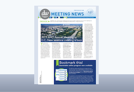 meeting news LP