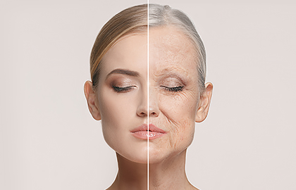 Image of facial comparison of aging skin