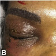 Card image for DWII on complications of microblading