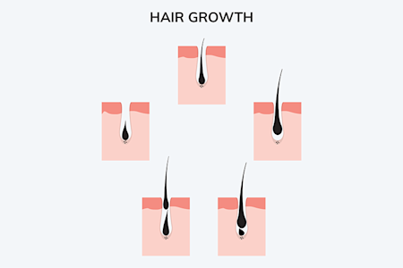 illustration of cycle of hair growth