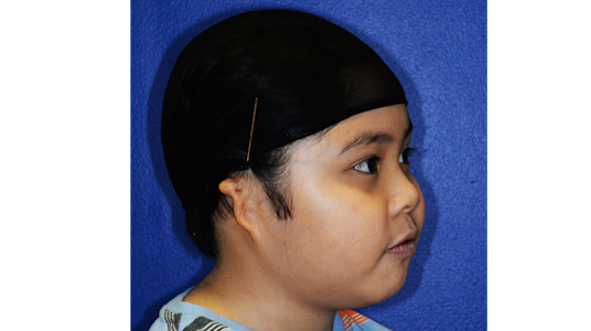 SIdra-Craniofacial-02