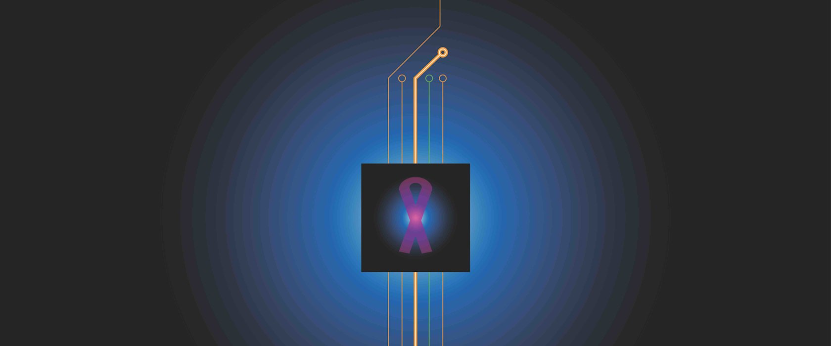 QF researcher underlines accuracy of AI in breast cancer detection through images