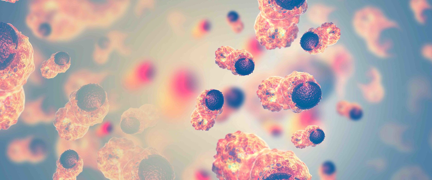 Precision medicine for breast cancer demands a multidisciplinary approach, says QF expert