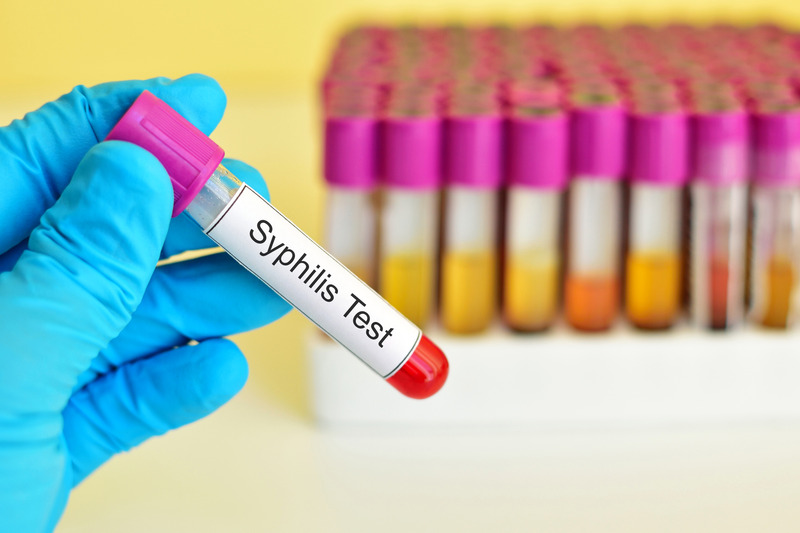 Syphilis-Test