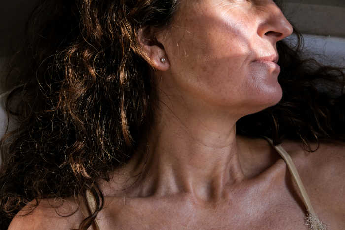 Frozen shoulder, een symptoom van de menopauze?