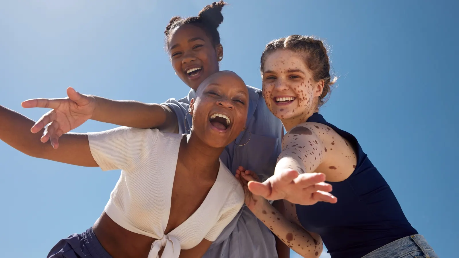 Three women under the clear sky, goofing in front of the camera
