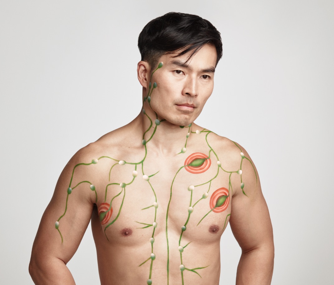 Body painting that shows how idiopathic multicentric Castleman disease can attack the lymph system.
