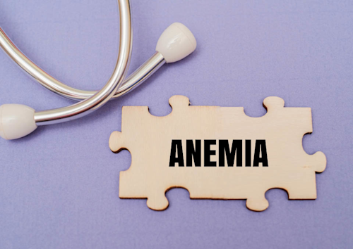 Un estetoscopio y una pieza de rompecabezas de madera en la que pone «Anemia»