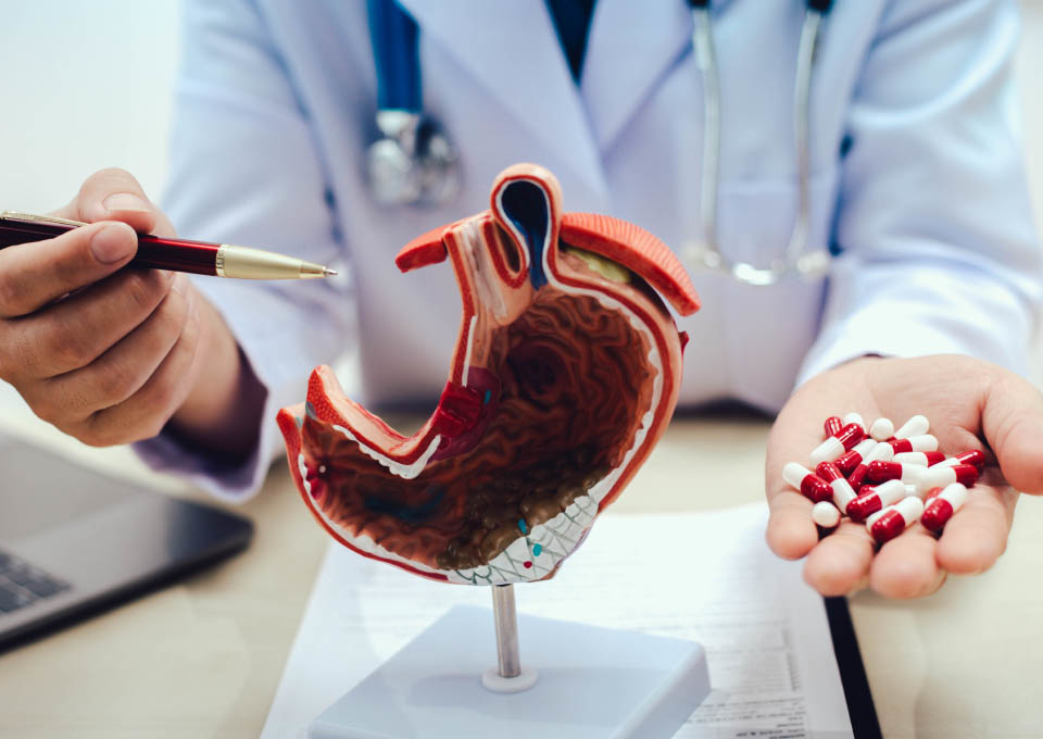 Un médico que sostiene unas cápsulas en una de sus manos mientras señala con un bolígrafo una maqueta de un estómago seccionado por la mitad