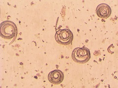 Parasites roundworms