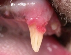 FORLtooth