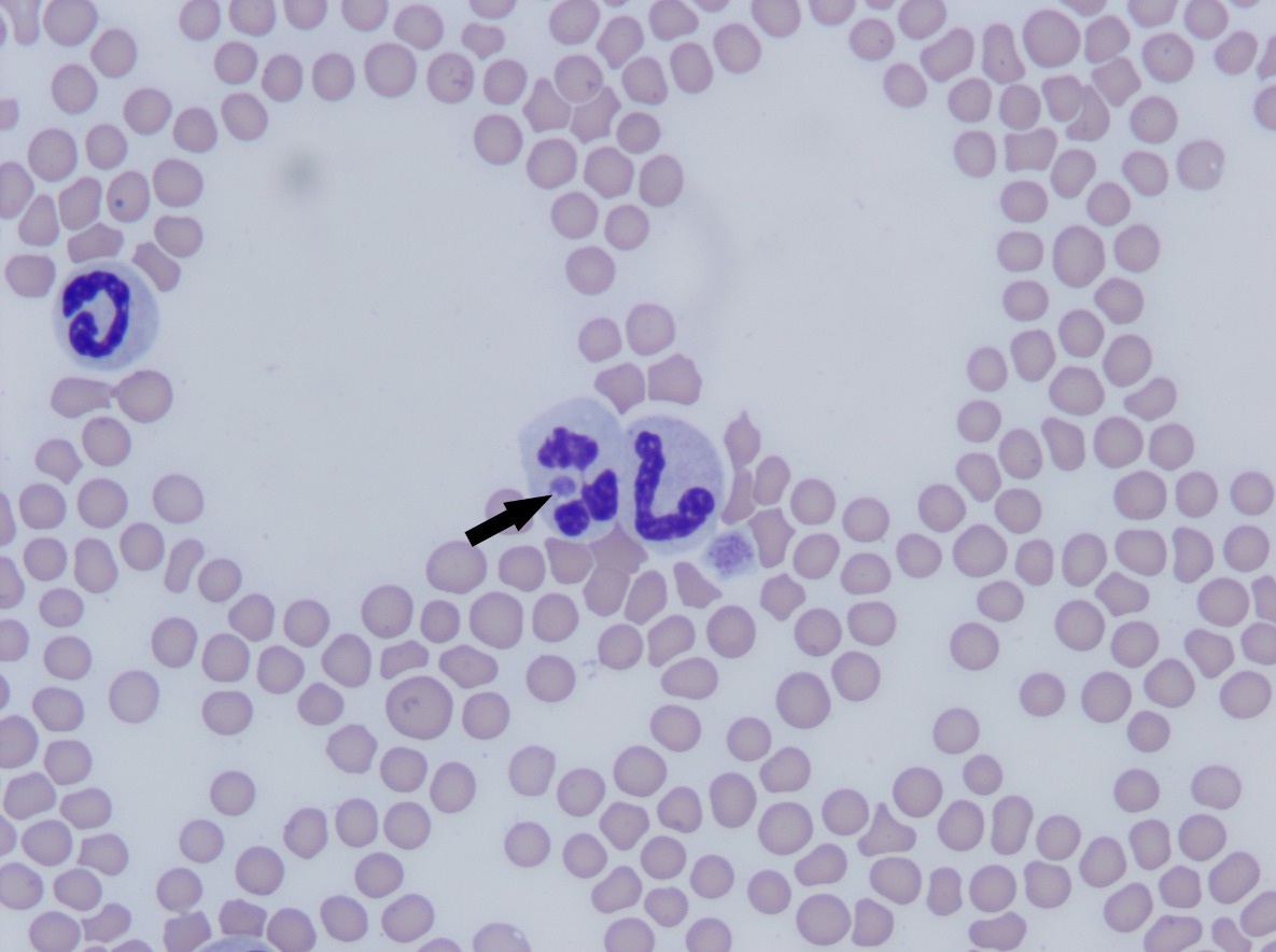 Clinical Image Feline Neutrophil