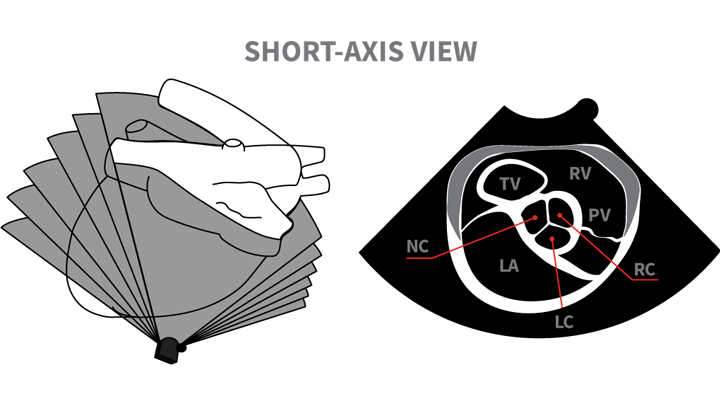 Echocardiography In General Practice Views To Master Clinician S Brief