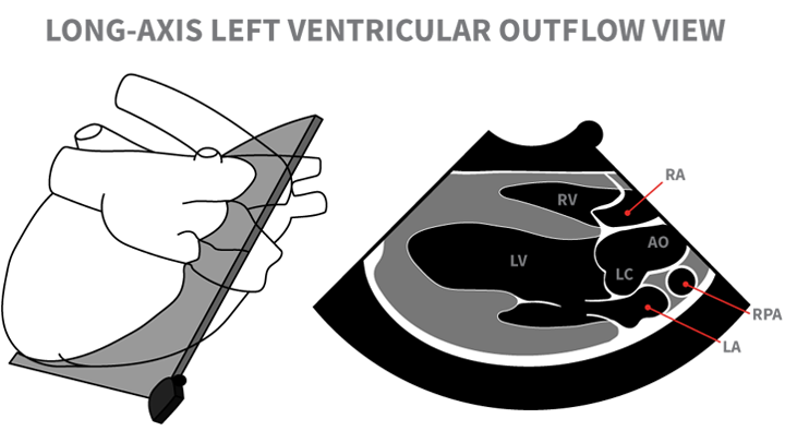 Echocardiography In General Practice Views To Master Clinician S Brief