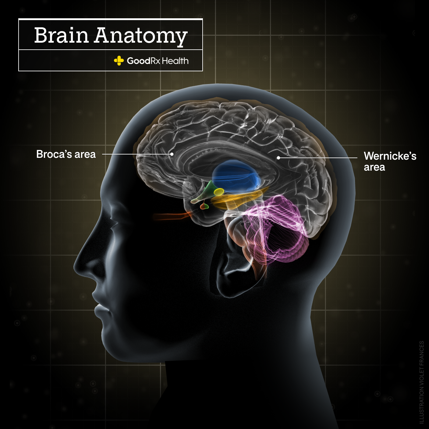 A 3D illustration of the brain anatomy including Broca’s area and Wernicke’s area.
