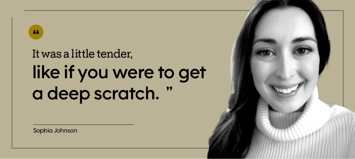 “It was a little tender, like if you were to get a deep scratch.” — Sophia Johnson