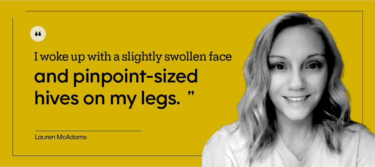 This is a portrait of Lauren McAdams, taken indoors, with the quote: “I woke up with a slightly swollen face and pinpoint-sized hives on my legs.”