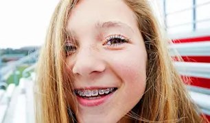 Cepillarse y lavarse los dientes con aparato article link