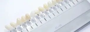 Carillas dentales: descubre qué son  y cuánto cuestan article link