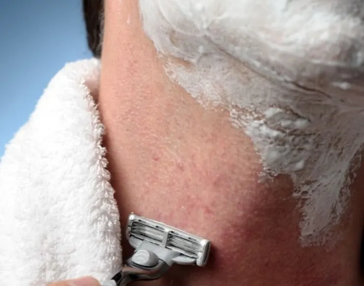 Wie man sich bei Pickeln und Akne rasiert