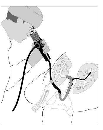 Bronchoscope