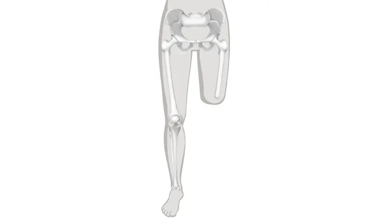 FirstSpiritExport,OBISCM-1557,web_site,prosthetics_2,infos_for_amputees