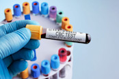 doctor with Blood tube test for Complete Blood Count