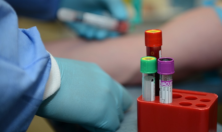 drug testing